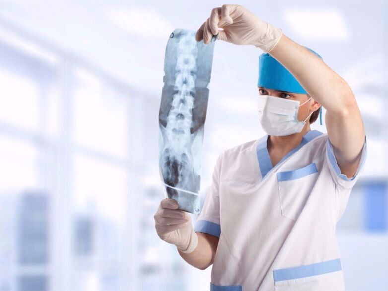 gydytojas žiūri į kaklo stuburo su osteochondroze momentinę nuotrauką