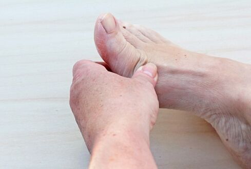 pėdos artrozė