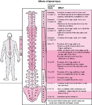 kūno ligos, susijusios su įvairių stuburo dalių pažeidimu