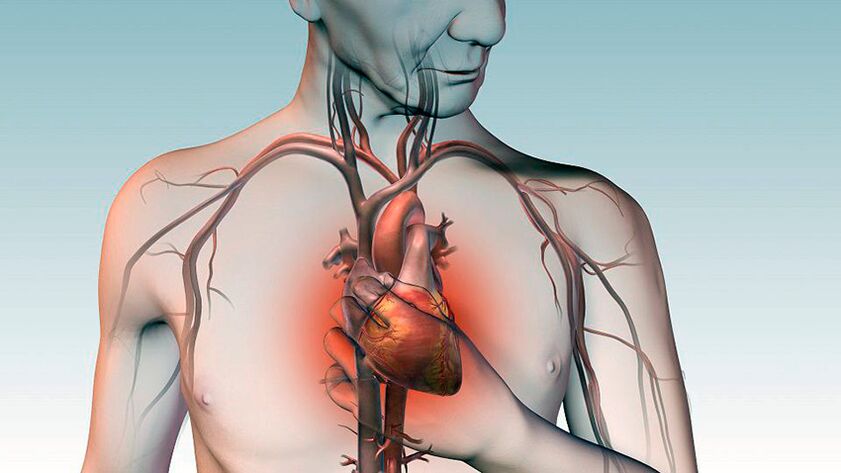 Skausmas po mentele ir spaudimas už krūtinkaulio su širdies liga